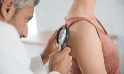 39465171 - dermatologist looking at woman's mole with magnifier